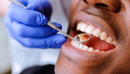 Dental patient having his teeth examined