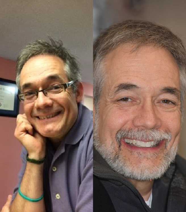 Man smiling before and after Invisalign treatment