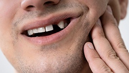 man smiling with missing tooth 