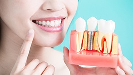 woman holding a model of dental implants while pointing to her smile