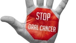 oral cancer