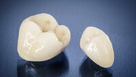 Two ceramic dental crowns