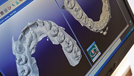 cerec machine