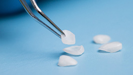 Close up of tweezers holding veneers