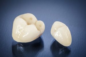 dental crowns