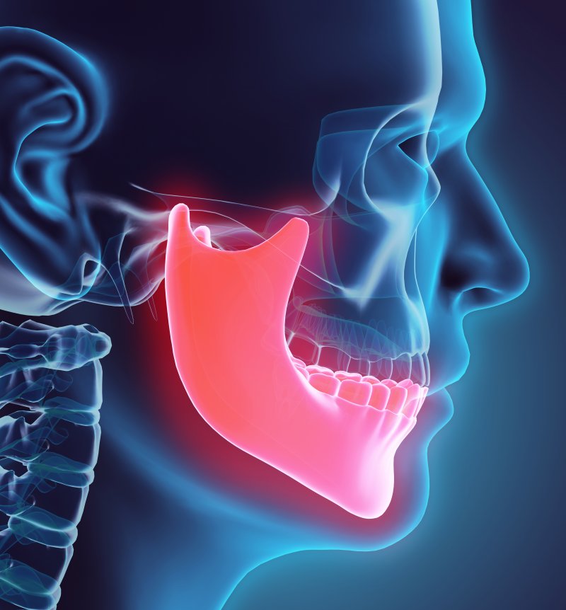 X-ray highlighting a patient’s lower jawbone