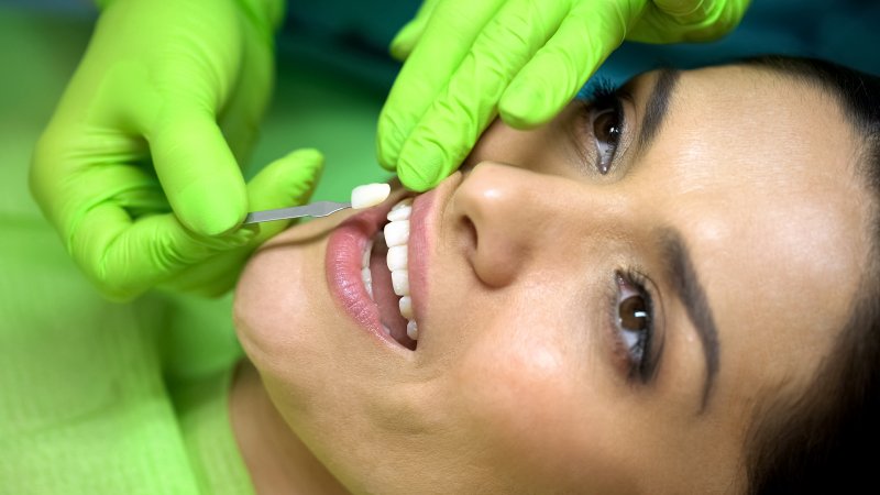 Woman getting porcelain veneers