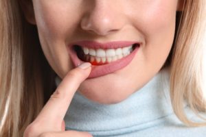 woman dealing with gum disease risk factors