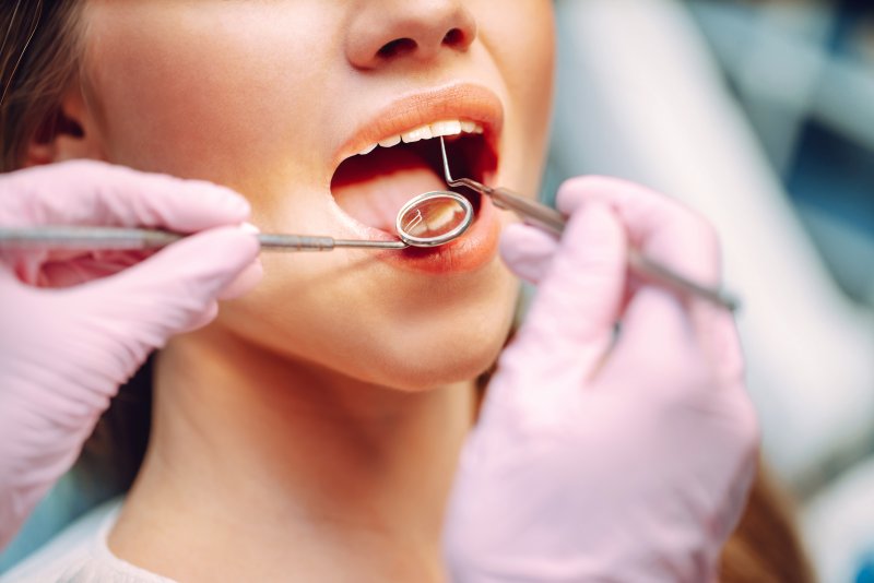 Dentist checking the back side of a young woman’s tooth