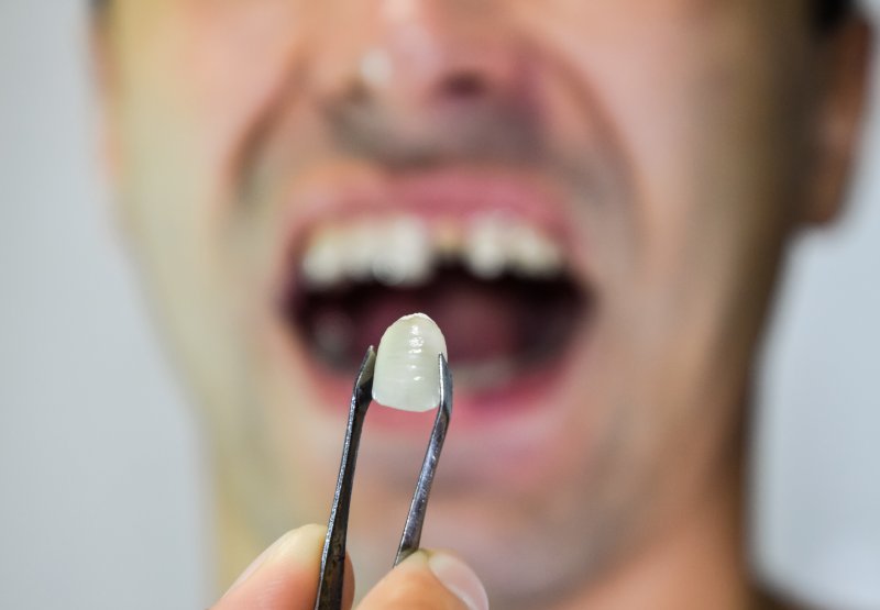 A person with a missing tooth holding a dental prosthesis