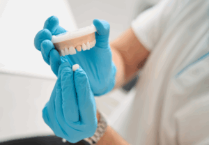 Dentist showing crown going on to mouth mold. 